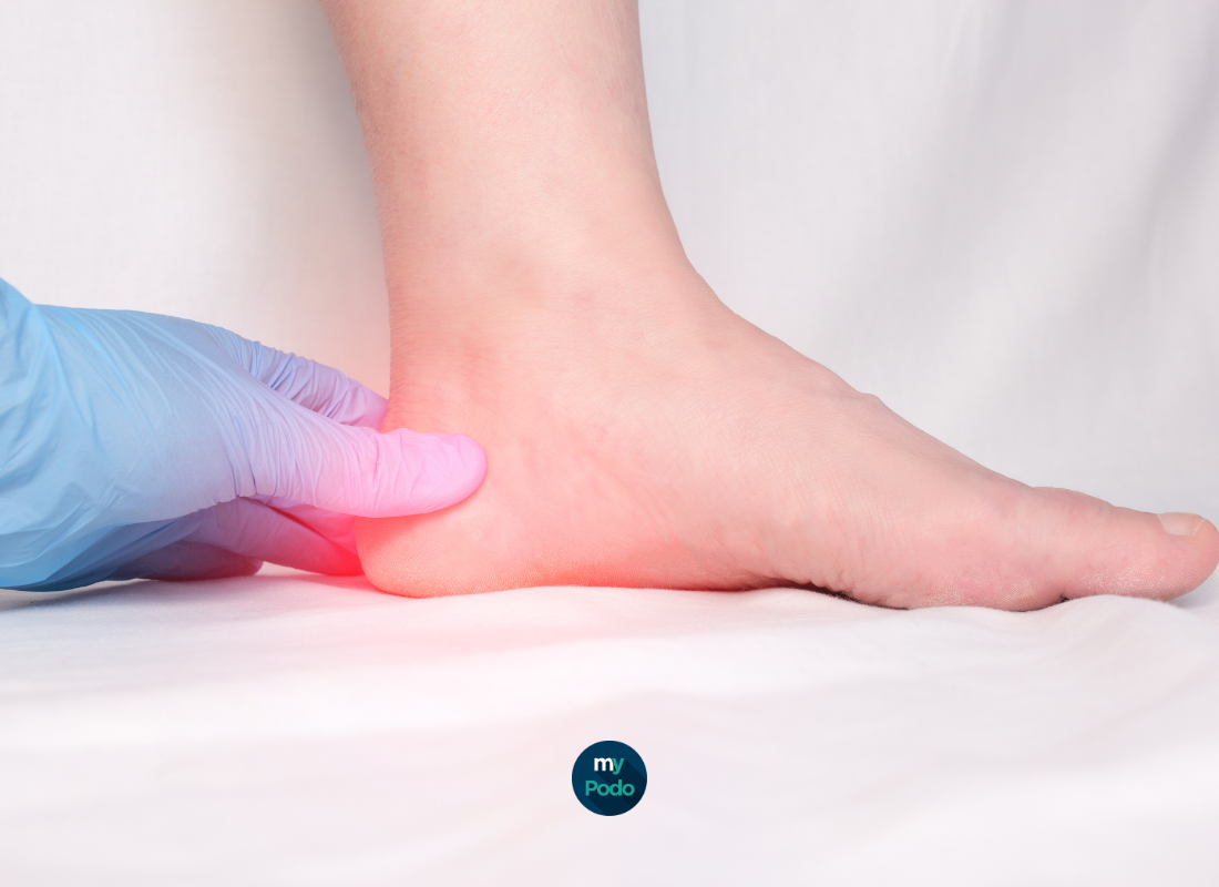 Talalgies : Comprendre et traiter les douleurs du talon en podologie -  My  Podologie