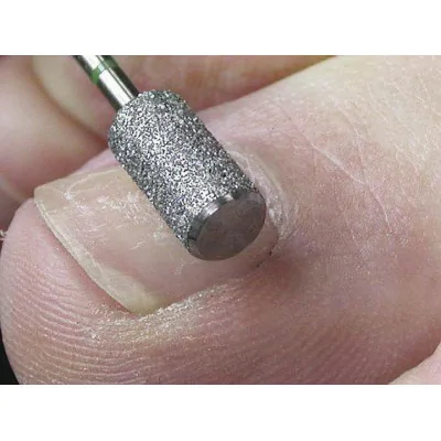 Fraise 6840LS Diamant - Abrasion des ongles - 6,5 mm