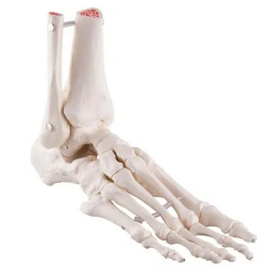 Squelette du pied avec moignon tibia et fibula (péroné), montage élastique, côté