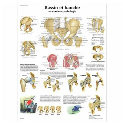 Planche anatomique - Bassin et hanche - Anatomie et pathologie