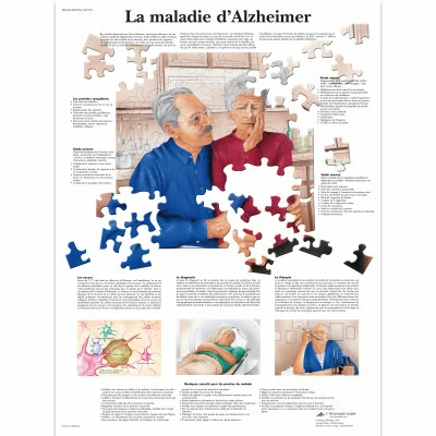 Planche anatomique - La maladie d'Alzheimer - Anatomie et pathologie