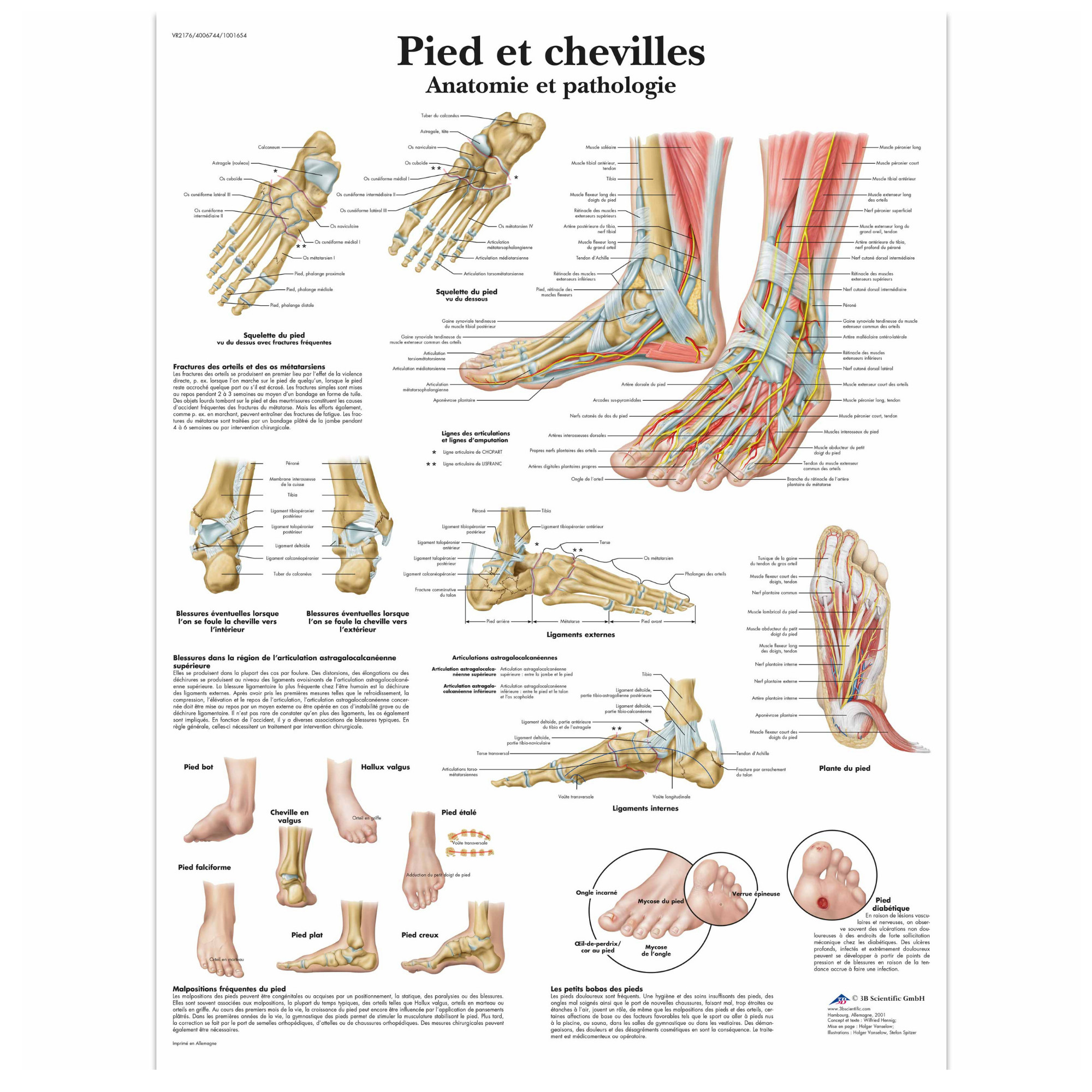 Planche anatomique - Pied et chevilles - Anatomie et pathologie