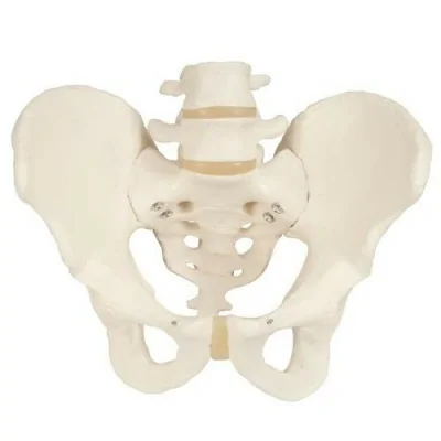 Squelette du bassin, masculin, avec moignons de fémur - Anatomie et pathologie