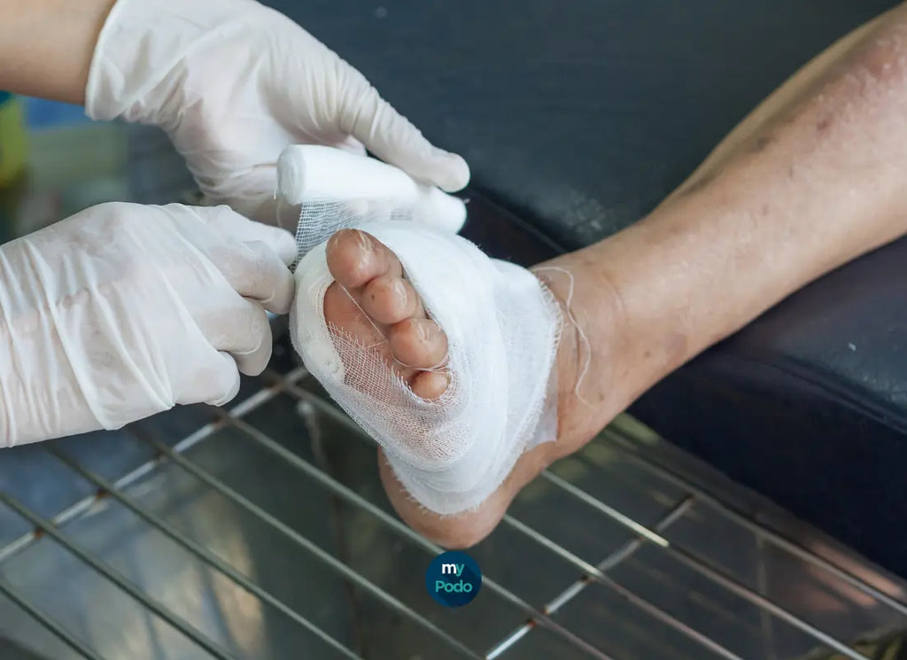 How long to keep a pressure dressing?  My Podologie
