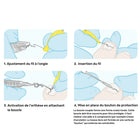 Alambres de ortonixia Ortogrip - Con aplicador - Ruck