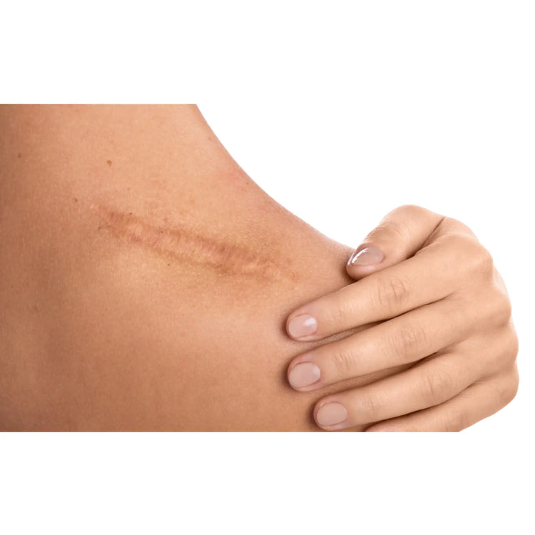 Huile de soin - Cica7 - Zones Cicatricielles - Roll-On - Eona Eona 