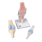 Modello in sezione dell'articolazione del ginocchio, in 3 parti - Anatomia e patologia